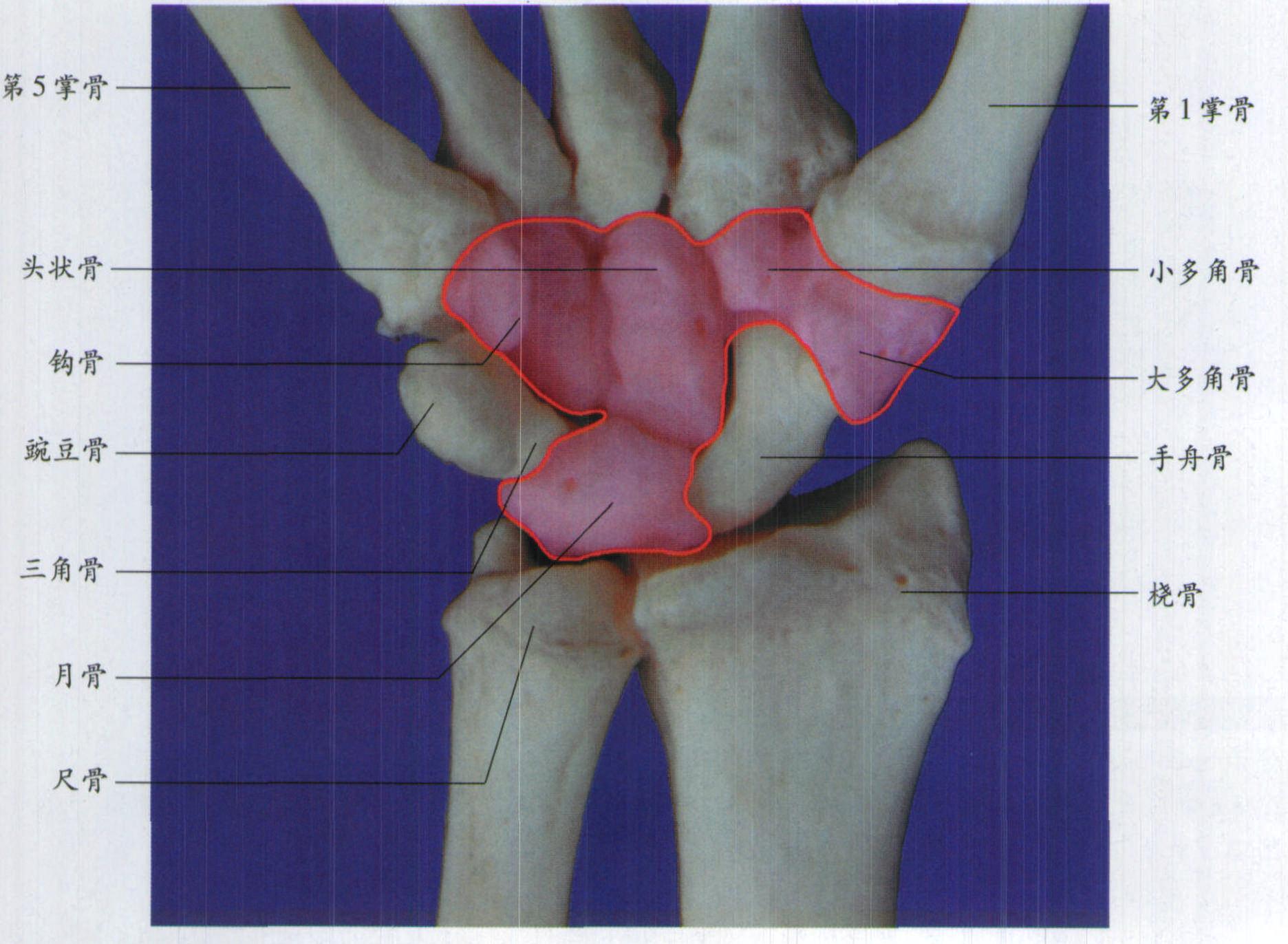 手腕|严重畸形18年手腕重获新生 假体系上海微创自主研发 手术|异种|re|基因编辑|猪心脏